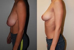 Before and After Image