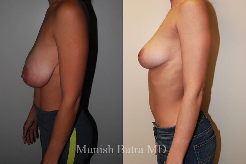 Before and After Image