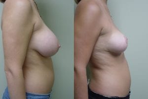 Before and After Image