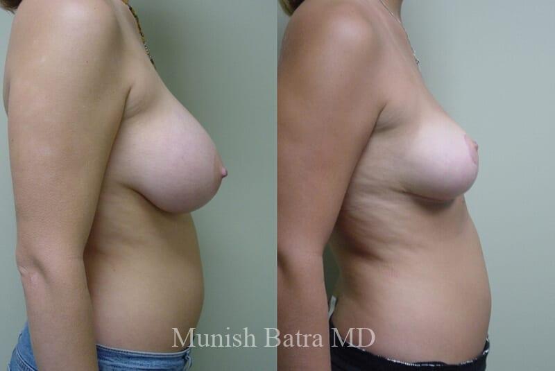 Before and After Image
