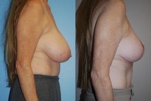 Before and After Image