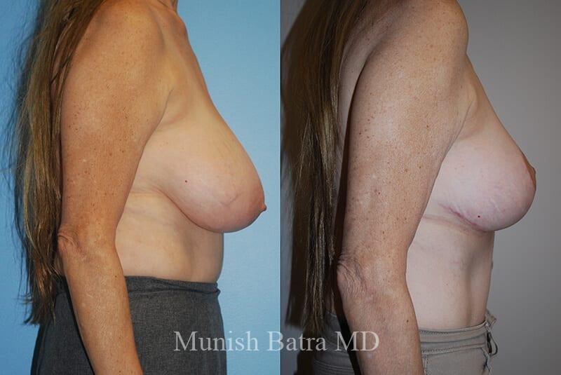 Before and After Image
