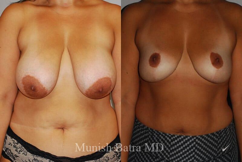 Before and After Image