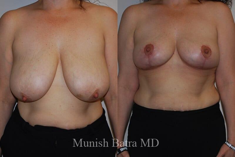 Before and After Image
