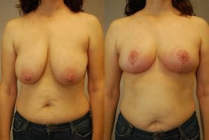 Before and After Image