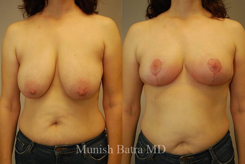 Before and After Image