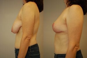 Before and After Image