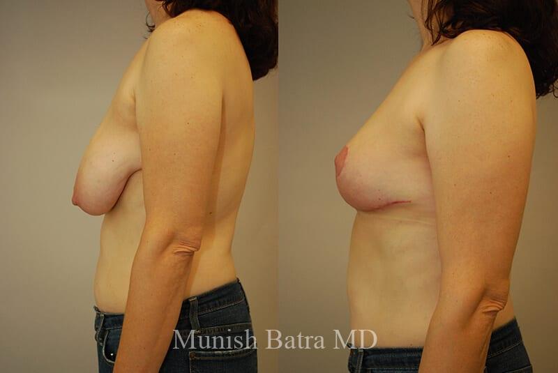 Before and After Image