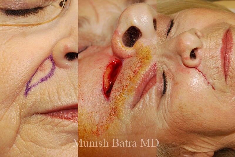 Before and After Image