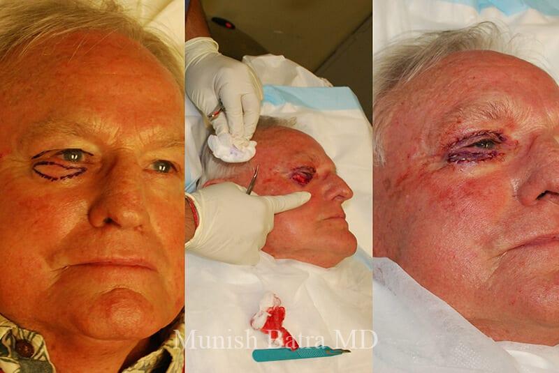Before and After Image
