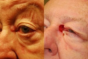 Before and After Image