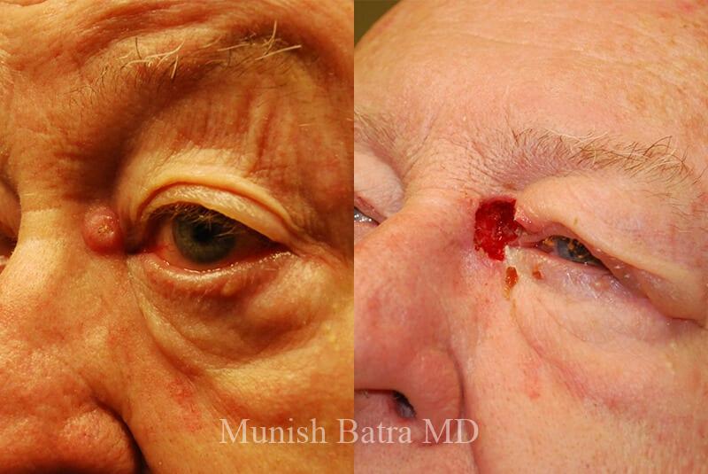 Before and After Image