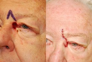 Before and After Image