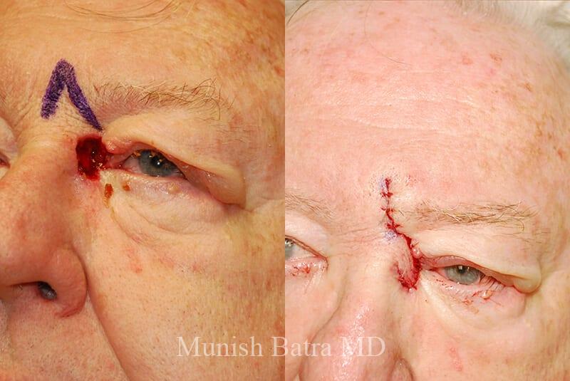 Before and After Image