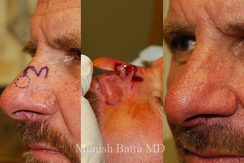Before and After Image