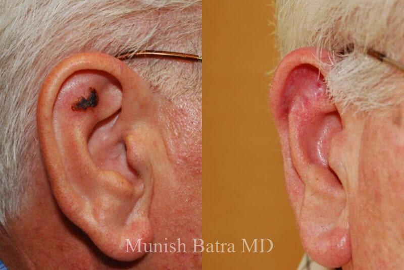 Before and After Image