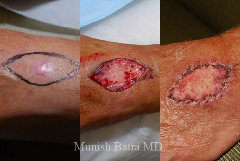 Before and After Image