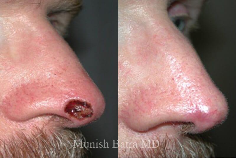 Before and After Image
