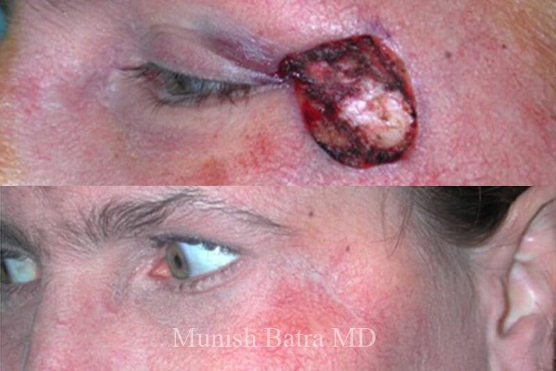 Before and After Image