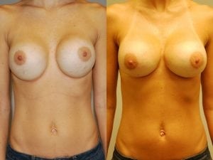 Before and After Image