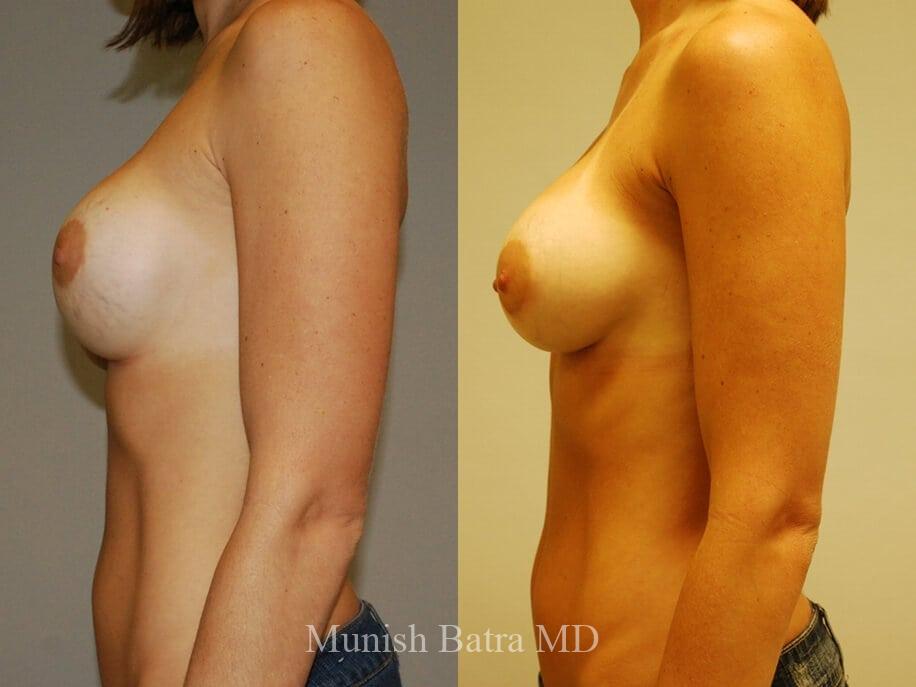 Before and After Image