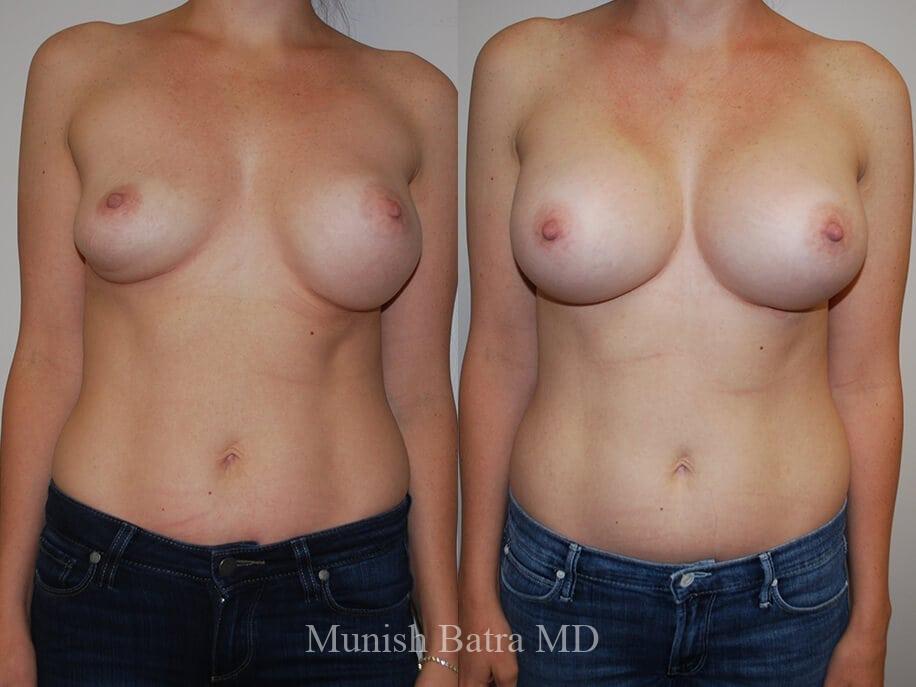 Before and After Image