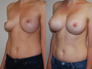 Before and After Image