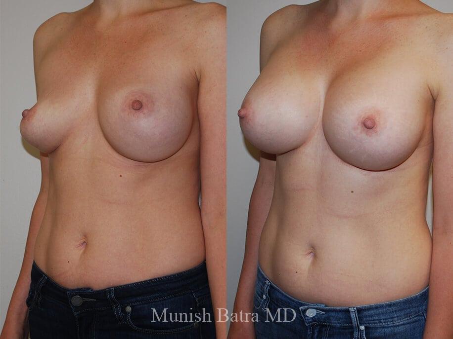 Before and After Image