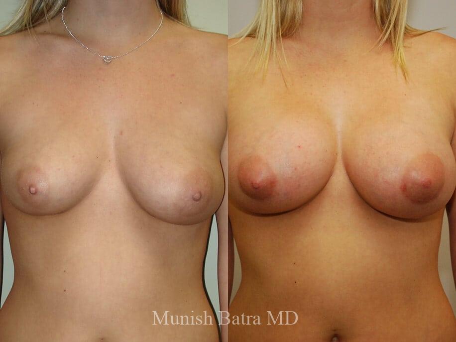 Before and After Image