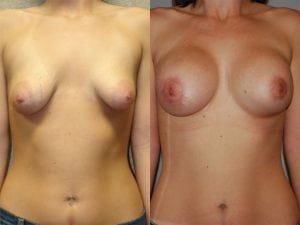 Before and After Image