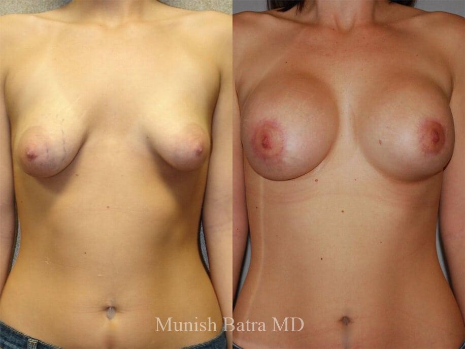 Before and After Image