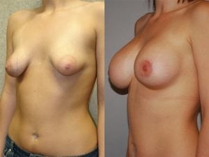 Before and After Image