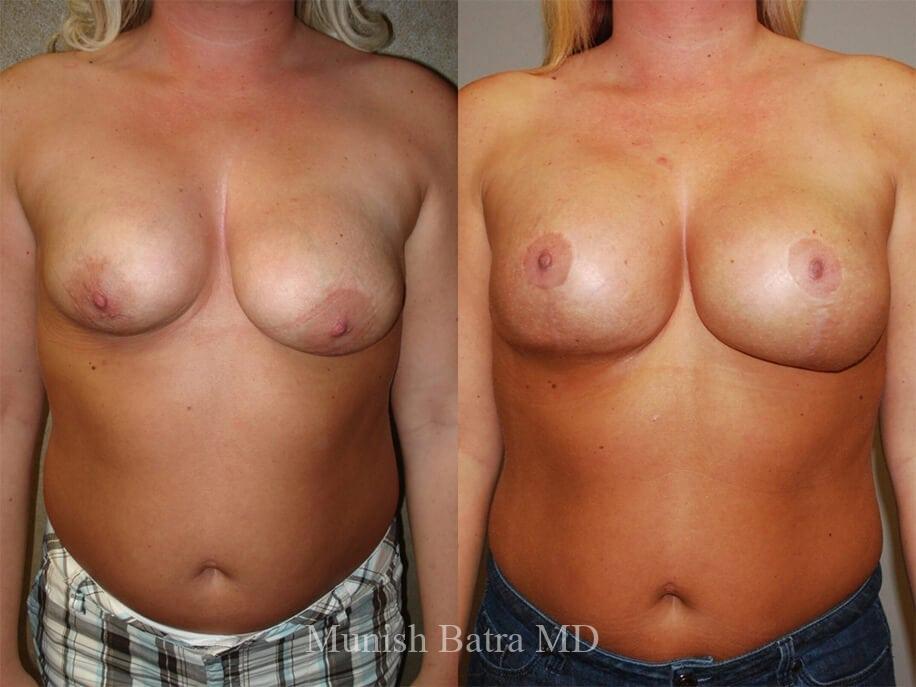 Before and After Image
