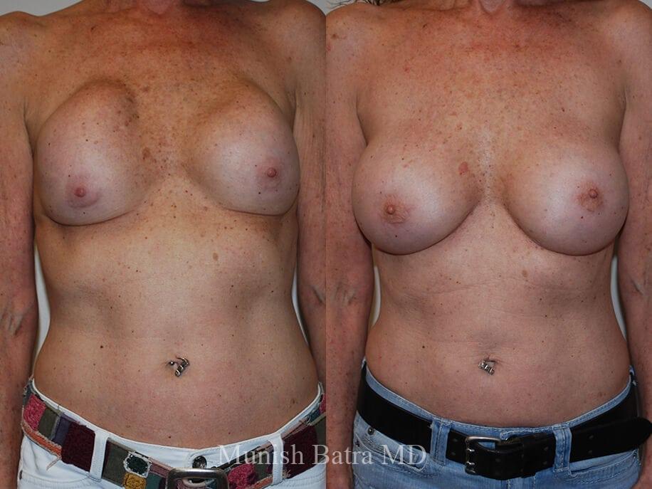 Before and After Image
