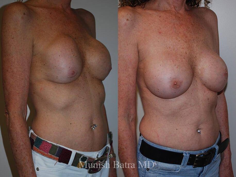 Before and After Image