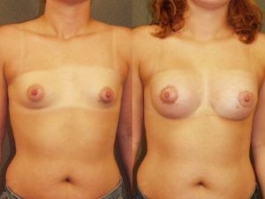 Before and After Image