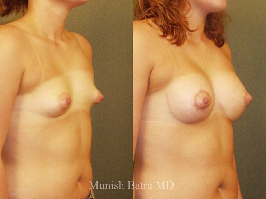 Before and After Image