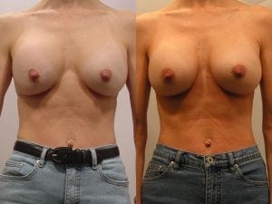 Before and After Image