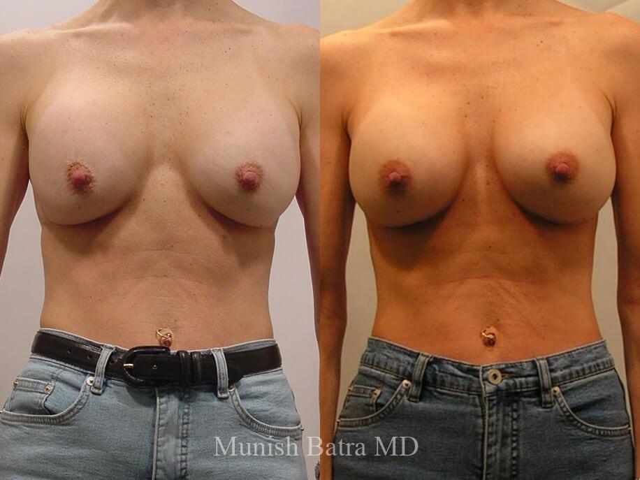 Before and After Image