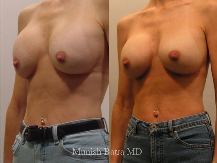 Before and After Image