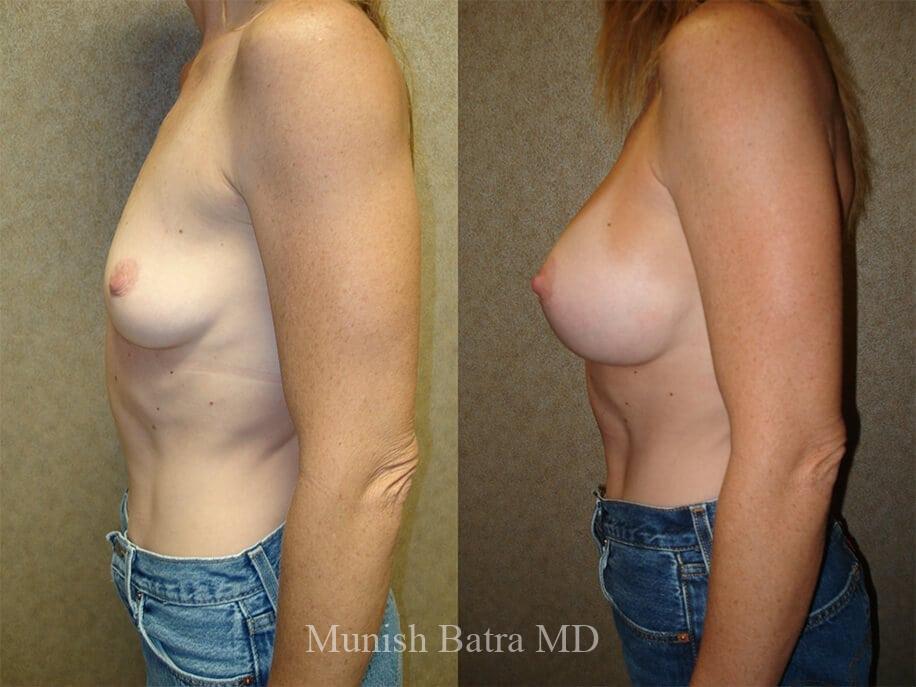 Before and After Image