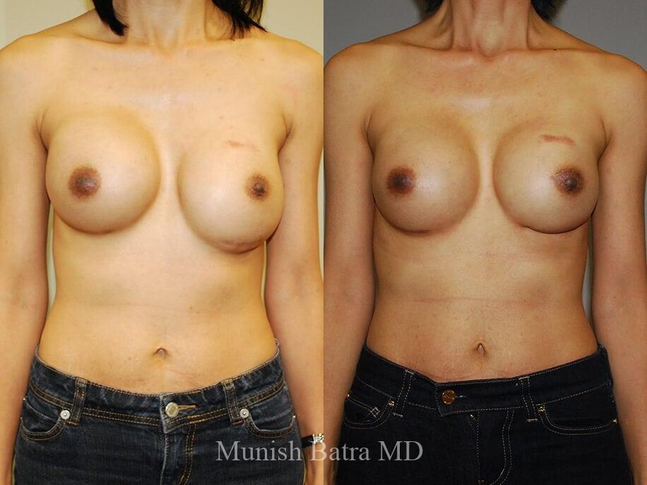 Before and After Image