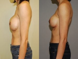 Before and After Image