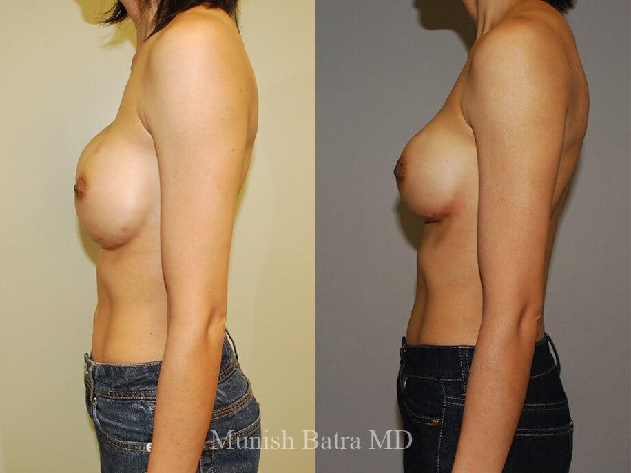 Before and After Image