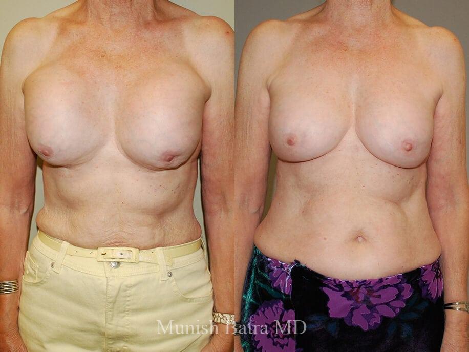 Before and After Image