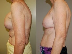 Before and After Image