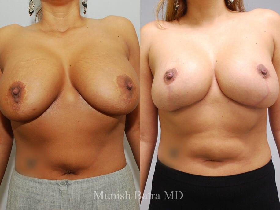 Before and After Image