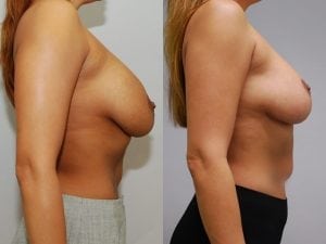 Before and After Image