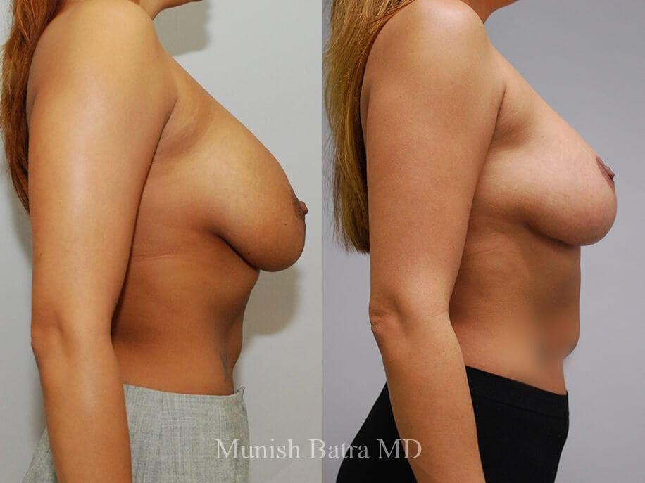 Before and After Image