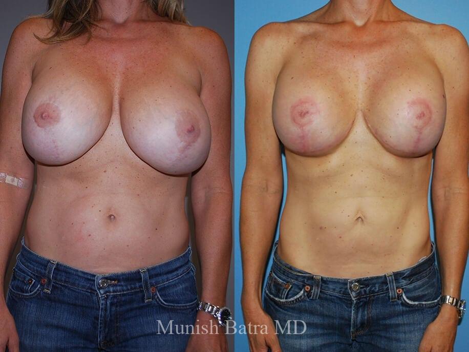 Before and After Image